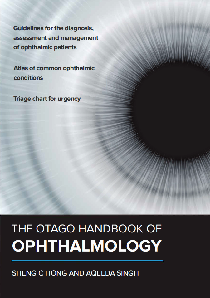 The Otago Handbook of Ophthalmology (Free eBook)
