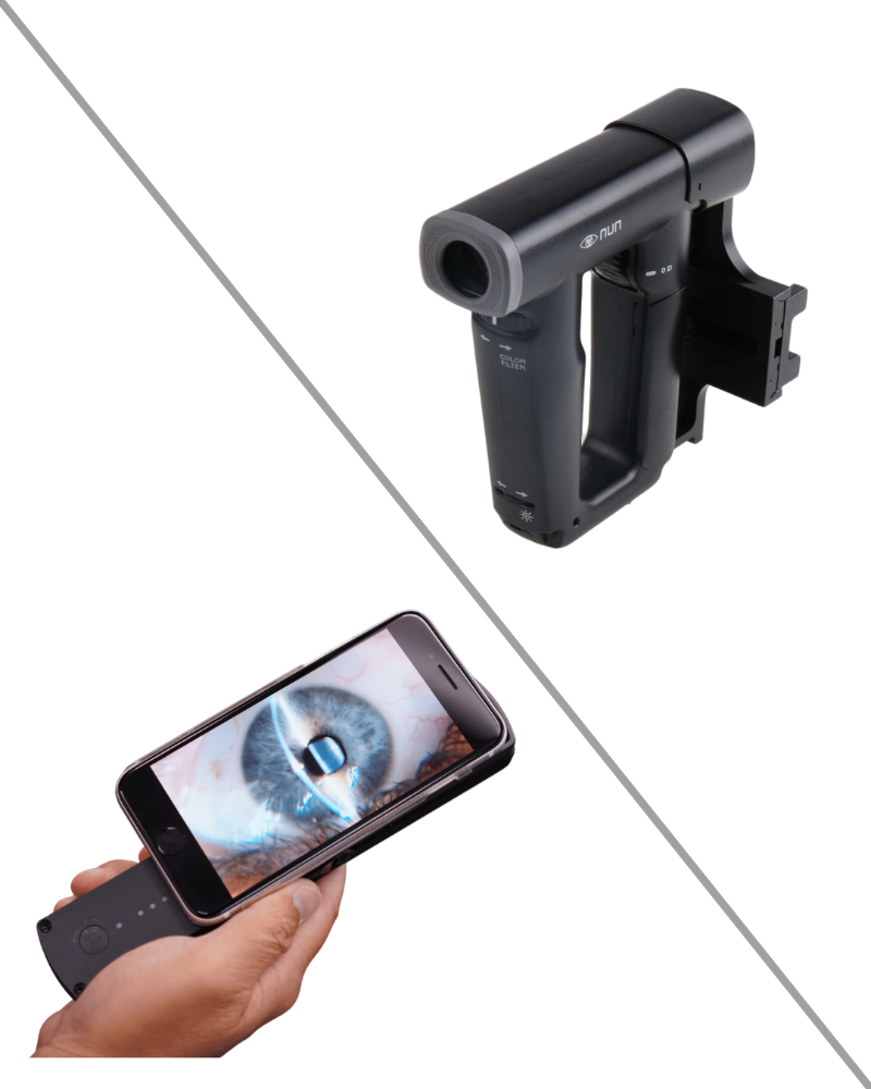 oDocs nun + Portable Slit Lamp Bundle