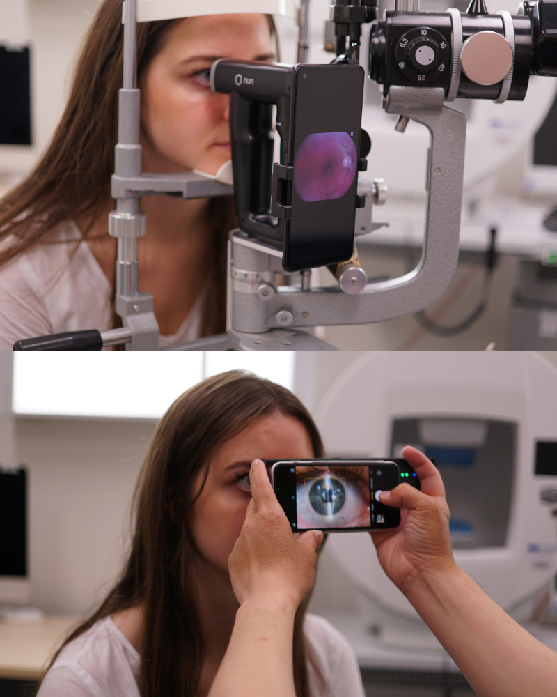 oDocs nun + Portable Slit Lamp Bundle