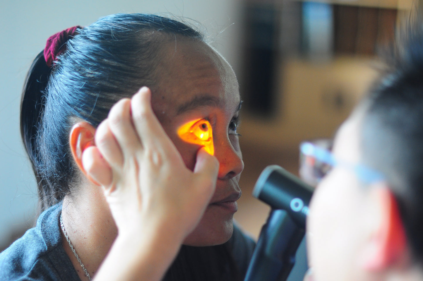 oDocs nun ophthalmoscope