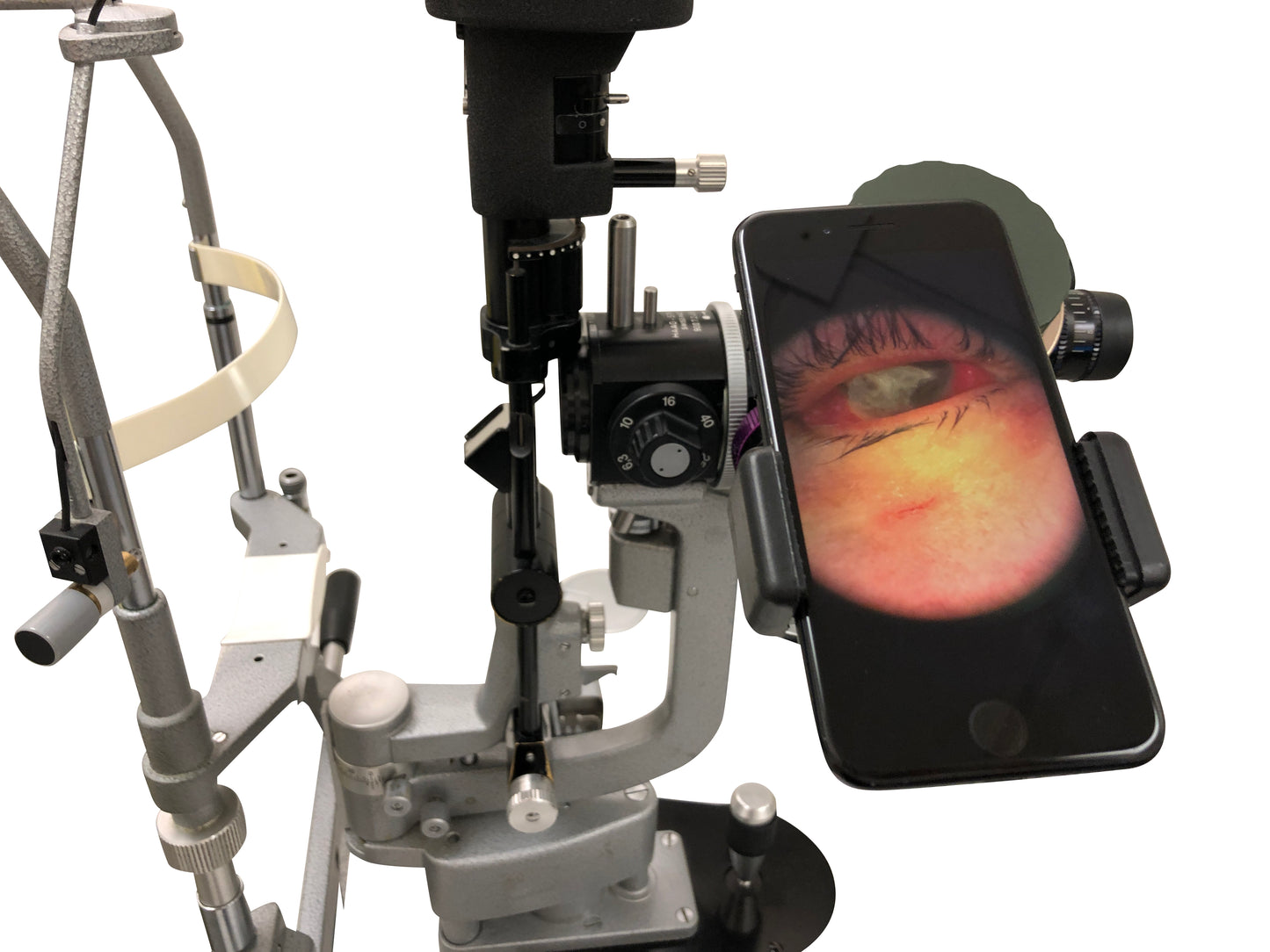 oDocs Slit Lamp & Surgical Microscope Adapter