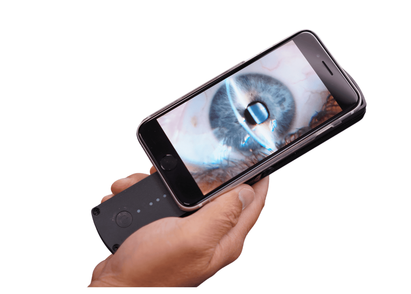 Portable Slit Lamp